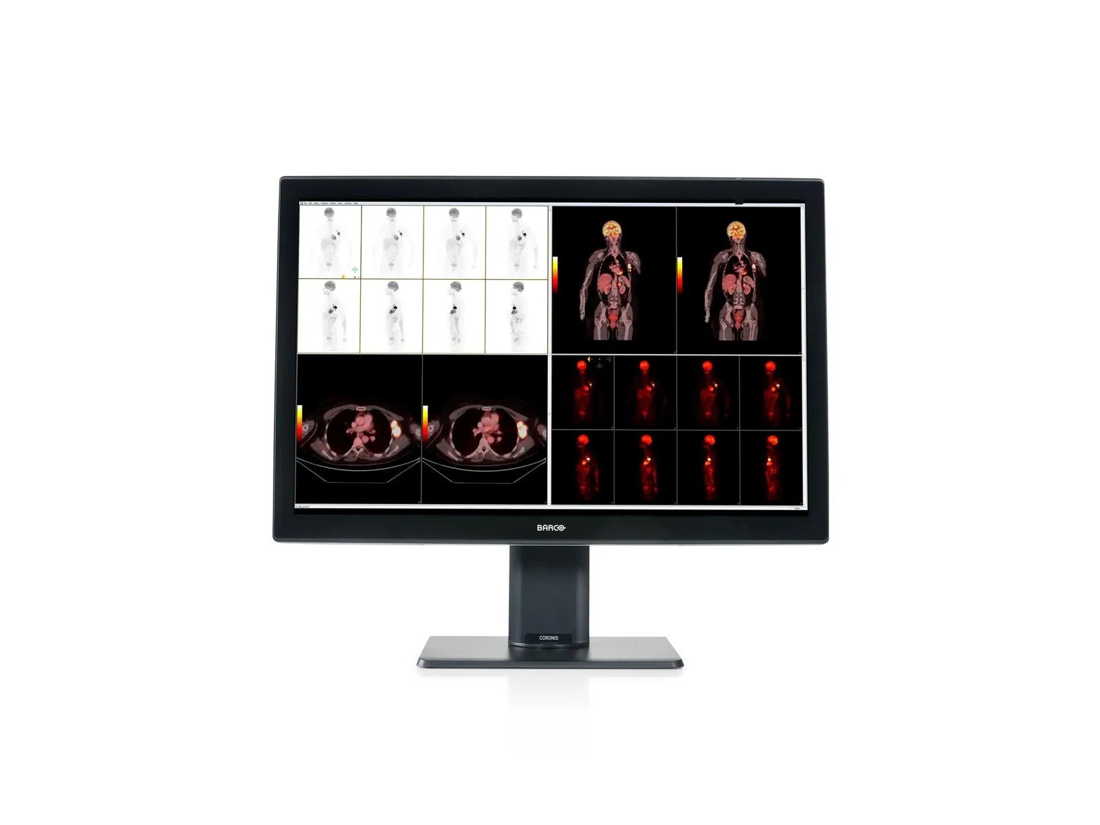 Barco Coronis medical display