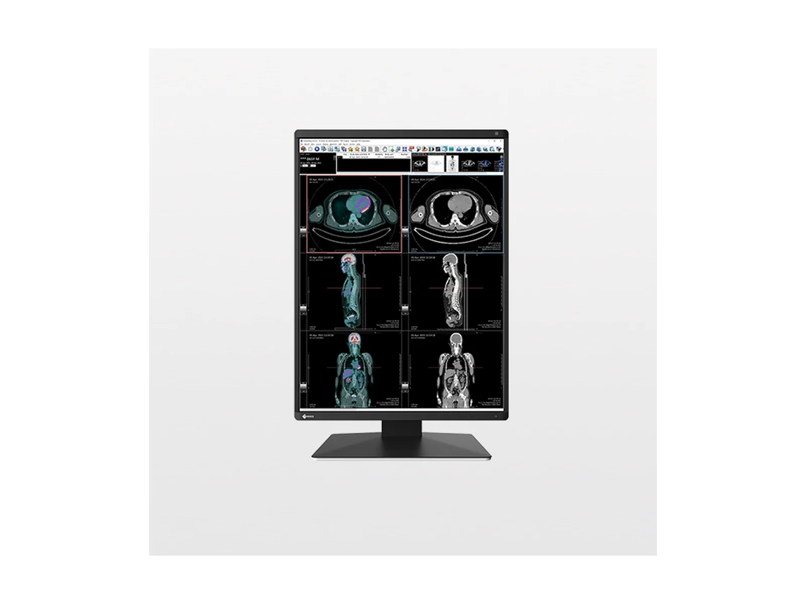 EIZO RadiForce RX370 diagnostic medical display
