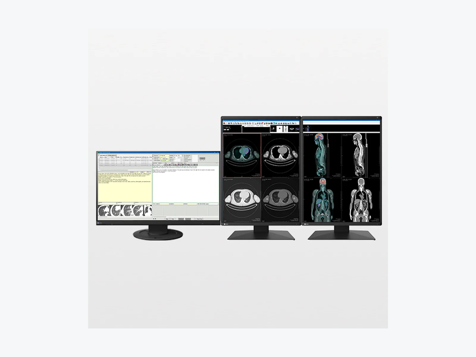 EIZO RadiForce three-monitor PACS workstation